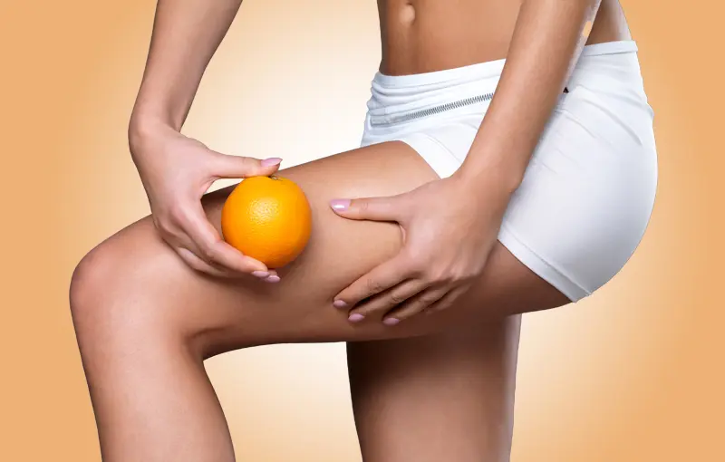 Cellulite mit Faden Düsseldorf